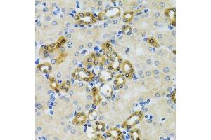 Immunohistochemistry of paraffin-embedded mouse kidney using PHPT1 antibody. (PHPT1 抗体  (AA 1-125))