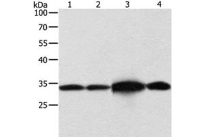 Western Blot analysis of Hela and Jurkat cell, Mouse brain tissue and 293T cell using NAPA Polyclonal Antibody at dilution of 1:500 (NAPA 抗体)