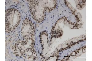 Immunoperoxidase of monoclonal antibody to ZNF3 on formalin-fixed paraffin-embedded human prostate. (ZNF3 抗体  (AA 1-110))