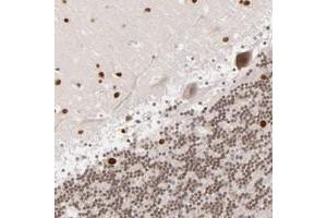 Immunohistochemical staining of human cerebellum with RP13-102H201 polyclonal antibody  shows nuclear positivity in purkinje cells, cells in molecular layer and cells in granular layer at 1:10-1:20 dilution. (ARHGAP36 抗体)