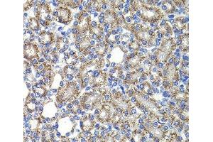 Immunohistochemistry of paraffin-embedded Rat kidney using COPS2 Polyclonal Antibody at dilution of 1:100 (40x lens). (COPS2 抗体)