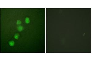 Immunofluorescence analysis of HuvEc cells, using Cyclin E1 (epitope around residue 395) antibody (ABIN5976158). (Cyclin E1 抗体  (Thr395))
