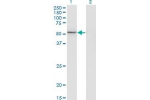 Western Blotting (WB) image for anti-GA Binding Protein Transcription Factor, alpha Subunit 60kDa (GABPA) (AA 1-454) antibody (ABIN560979)