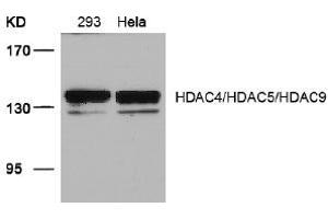 Image no. 3 for anti-HDAC4,HDAC5,HDAC9 (Ser220), (Ser246), (Ser259) antibody (ABIN319389) (HDAC4/HDAC5/HDAC9 抗体  (Ser220, Ser246, Ser259))