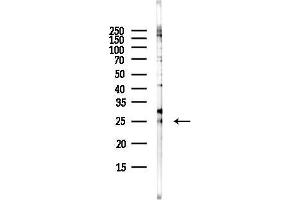 Western blot analysis of lysates from EC304 cells(LPS, 4h treatment), using GH1 Antibody at 1/1000 dilution.