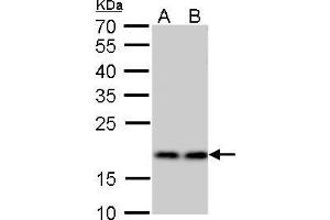 Western Blotting (WB) image for anti-Ribosomal Protein S15 (RPS15) antibody (ABIN2855194)