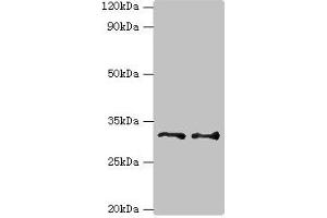 Western blot All lanes: Tumor necrosis factor receptor superfamily member 27 antibody at 6 μg/mL Lane 1: HepG2 whole cell lysate Lane 2: Hela whole cell lysate Secondary Goat polyclonal to rabbit IgG at 1/10000 dilution Predicted band size: 33, 36 kDa Observed band size: 33 kDa (Ectodysplasin A2 Receptor 抗体  (AA 1-138))