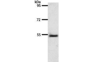 Western Blot analysis of Human liver cancer tissue using A1BG Polyclonal Antibody at dilution of 1:500 (A1BG 抗体)