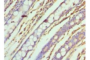 Immunohistochemistry (IHC) image for anti-ASF1 Anti-Silencing Function 1 Homolog A (S. Cerevisiae) (ASF1A) (AA 1-204) antibody (ABIN7155295)