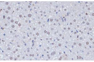 Immunohistochemistry of paraffin-embedded Rat liver using PCNA Polyclonal Antibody at dilution of 1:100 (40x lens). (PCNA 抗体)