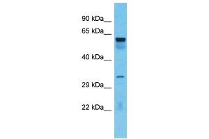 Host:  Rabbit  Target Name:  TOX4  Sample Type:  Lung tumor lysates  Antibody Dilution:  1. (TOX4 抗体  (C-Term))