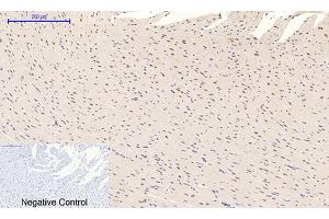 Immunohistochemical analysis of paraffin-embedded rat heart tissue. (MAPK14 抗体  (pThr180))