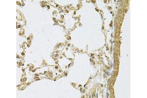 Immunohistochemistry of paraffin-embedded Rat lung using PSMA5 Polyclonal Antibody at dilution of 1:100 (40x lens). (PSMA5 抗体)