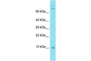 Host: Rabbit Target Name: C7orf49 Sample Type: MDA-MB-435S Whole Cell lysates Antibody Dilution: 1.