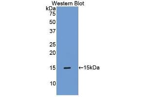 Western Blotting (WB) image for anti-TIMP Metallopeptidase Inhibitor 1 (TIMP1) (AA 35-160) antibody (ABIN1173100) (TIMP1 抗体  (AA 35-160))