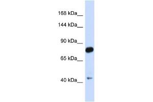 Host:  Rabbit  Target Name:  CDH23  Sample Type:  Fetal Brain lysates  Antibody Dilution:  1. (CDH23 抗体  (N-Term))