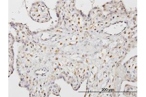 Immunoperoxidase of monoclonal antibody to STK33 on formalin-fixed paraffin-embedded human placenta. (STK33 抗体  (AA 1-514))