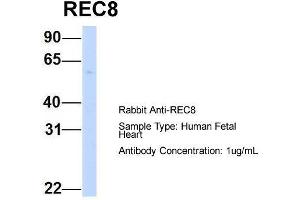 Host:  Rabbit  Target Name:  REC8  Sample Type:  Human Fetal Heart  Antibody Dilution:  1. (REC8 抗体  (N-Term))