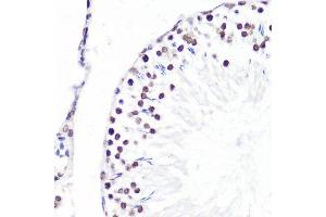 Immunohistochemistry (Paraffin-embedded Sections) (IHC (p)) image for anti-Histone 3 (H3) (H3K36me2) antibody (ABIN3016036)