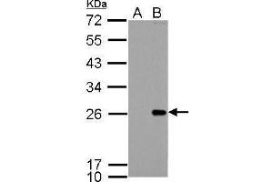 Bcl-2 antibody  (N-Term)