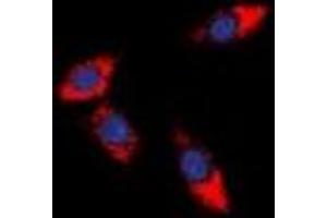 Immunofluorescent analysis of PDCD12 staining in HeLa cells. (AVEN 抗体  (C-Term))