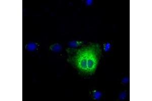Anti-TBXAS1 mouse monoclonal antibody (ABIN2453709) immunofluorescent staining of COS7 cells transiently transfected by pCMV6-ENTRY TBXAS1 (RC208028). (TBXAS1 抗体)