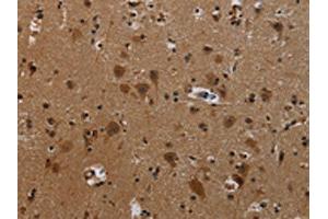 The image on the left is immunohistochemistry of paraffin-embedded Human brain tissue using ABIN7191807(PCDHB11 Antibody) at dilution 1/50, on the right is treated with synthetic peptide. (PCDHB11 抗体)