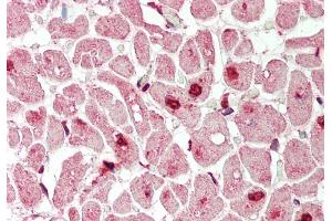 Rabbit Anti-Mxi1 antibody  Formalin Fixed Paraffin Embedded Tissue: Human Heart Primary antibody Concentration: 1:200 Secondary Antibody: Donkey anti-Rabbit-Cy3 Secondary Antibody Concentration: 1:200 Magnification: 20x Exposure Time: 0. (MXI1 抗体  (N-Term))