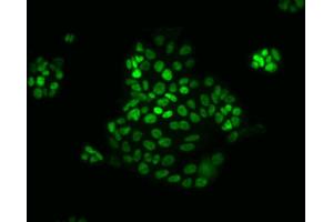 Immunofluorescent staining of human colorectal adenocarcinoma. (CDX2 抗体)