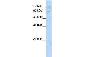PDE9A antibody used at 1 ug/ml to detect target protein. (PDE9A 抗体  (N-Term))