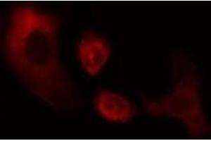 ABIN6274966 staining Hela cells by IF/ICC. (CES2 抗体  (N-Term))