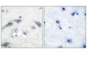Immunohistochemical analysis of paraffin-embedded human brain tissue using DARPP-32 (Ab-75) antibody. (DARPP32 抗体  (Thr75))