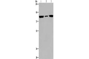 Gel: 6 % SDS-PAGE, Lysate: 40 μg, Lane 1-3: A549 cells, mouse heart tissue, Hela cells, Primary antibody: ABIN7130075(LEPREL2 Antibody) at dilution 1/300, Secondary antibody: Goat anti rabbit IgG at 1/8000 dilution, Exposure time: 20 seconds (LEPREL2 抗体)