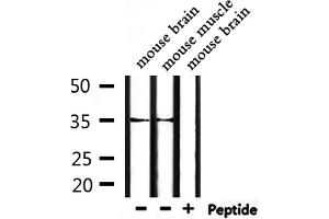 Western blot analysis of extracts from mouse brain and mouse muscle, using OR52P1 Antibody. (OR52P1 抗体)