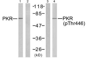 Western blot analysis of extracts from K562 cells, using PKR (Ab-446) antibody (E021272, Line 1 and 2) and PKR (phospho-Thr446) antibody (E011280, Line 3 and 4). (EIF2AK2 抗体)