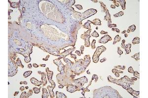 IHC analysis of HOOK3 using anti-HOOK3 antibody (ABIN6719547).