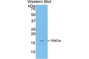Western blot analysis of the recombinant protein. (CD70 抗体  (AA 64-192))