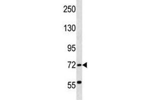 Western Blotting (WB) image for anti-ATP-Binding Cassette, Sub-Family F (GCN20), Member 2 (ABCF2) (AA 3-32) antibody (ABIN5647445)