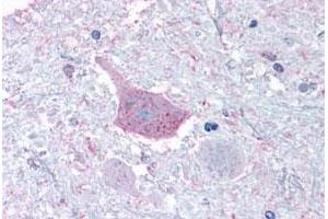 Immunohistochemical staining of human brain, medulla with MRGPRD polyclonal antibody . (MRGPRD 抗体  (Cytoplasmic Domain))