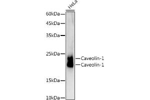 Western blot analysis of extracts of HeLa cells, using Caveolin-1 antibody (ABIN7266154) at 1:1000 dilution. (Caveolin-1 抗体)