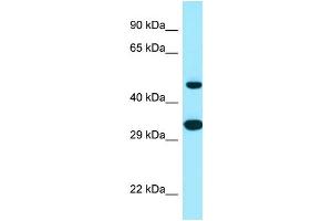 Western Blotting (WB) image for anti-Stearoyl-CoA Desaturase 5 (SCD5) (C-Term) antibody (ABIN2790026)