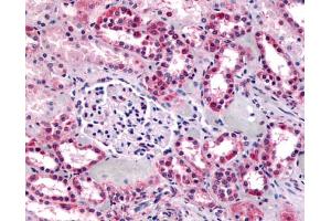 Anti-GPR91 antibody IHC of human kidney. (SUCNR1 抗体  (C-Term))