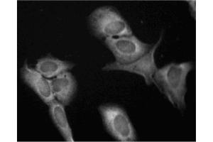 Immunofluorescence (IF) image for anti-Eukaryotic Translation Initiation Factor 4E (EIF4E) (AA 1-217) antibody (ABIN967870) (EIF4E 抗体  (AA 1-217))