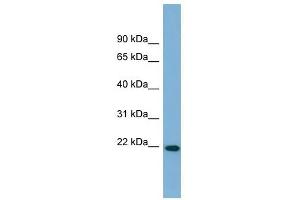 FNDC4 antibody used at 1 ug/ml to detect target protein. (FNDC4 抗体  (Middle Region))