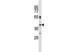 MAPK11 antibody western blot analysis in K562 lysate (MAPK11 抗体  (AA 133-161))