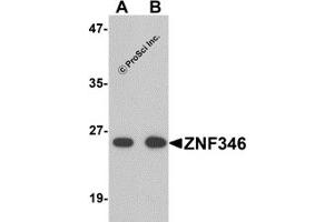 Western Blotting (WB) image for anti-Zinc Finger Protein 346 (ZNF346) (N-Term) antibody (ABIN1031685) (ZNF346 抗体  (N-Term))