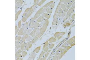 Immunohistochemistry of paraffin-embedded rat heart using CA3 Antibody (ABIN5970554) at dilution of 1/200 (40x lens). (CA3 抗体)