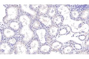 Detection of aHSP in Human Kidney Tissue using Monoclonal Antibody to Alpha-Hemoglobin Stabilizing Protein (aHSP) (aHSP 抗体  (AA 1-102))