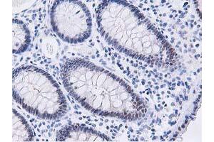 Immunohistochemical staining of paraffin-embedded Human colon tissue using anti-DPP3 mouse monoclonal antibody. (DPP3 抗体)
