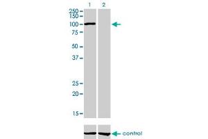 Western blot analysis of AHR over-expressed 293 cell line, cotransfected with AHR Validated Chimera RNAi (Lane 2) or non-transfected control (Lane 1).